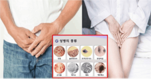 매독 일부성병